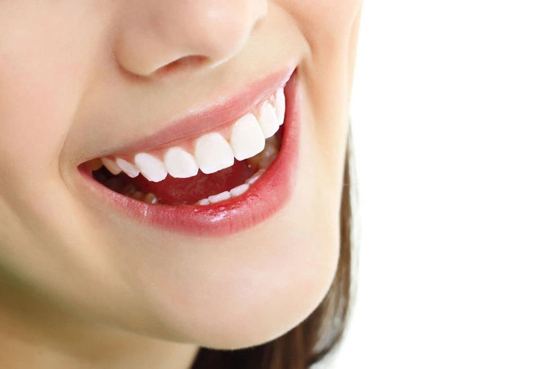 Phương pháp chữa răng hô nhẹ không cần niềng1