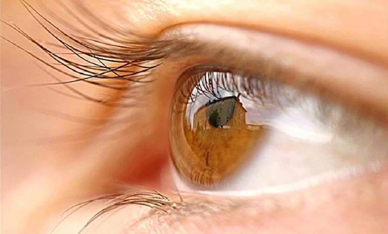 Quặm mi bẩm sinh nếu không được điều trị sớm sẽ ảnh hưởng trực tiếp thị lực 2