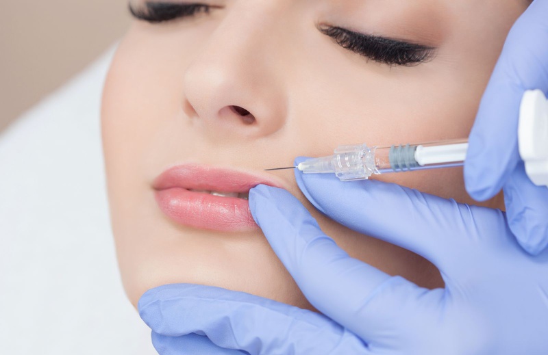 Những ai nên và không nên thực hiện tiêm Filler môi