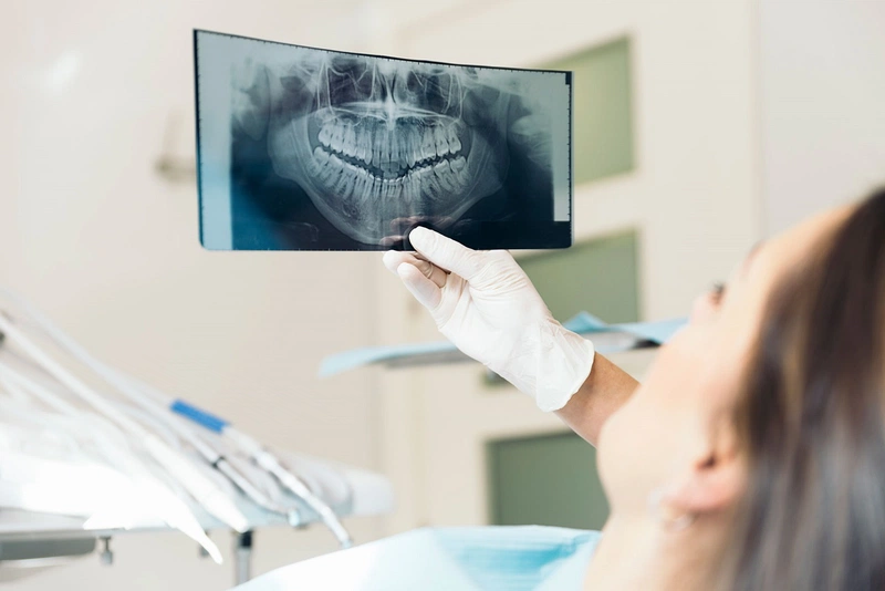 Quy trình niềng răng khớp cắn sâu gồm mấy bước?2