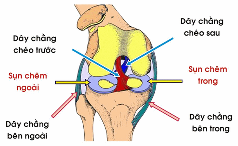 Rách sụn chêm: Dấu hiệu, nguyên nhân và hướng điều trị 3