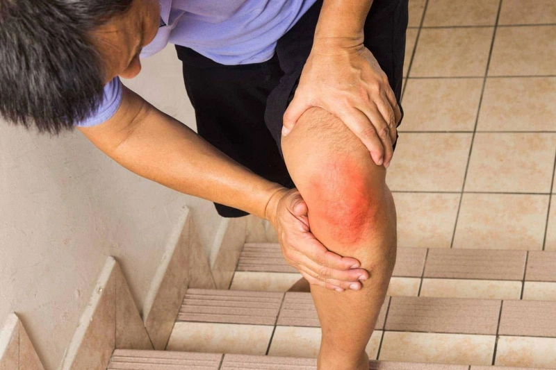 Rách sụn chêm nên ăn gì? Lợi ích của chế độ dinh dưỡng cho các bệnh về xương khớp 1