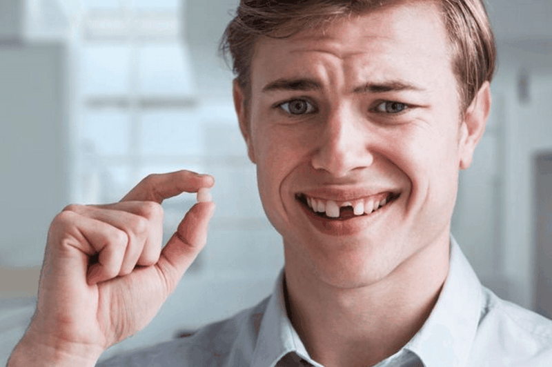 Răng đã lấy tủy có niềng được không? Trường hợp không nên niềng răng3