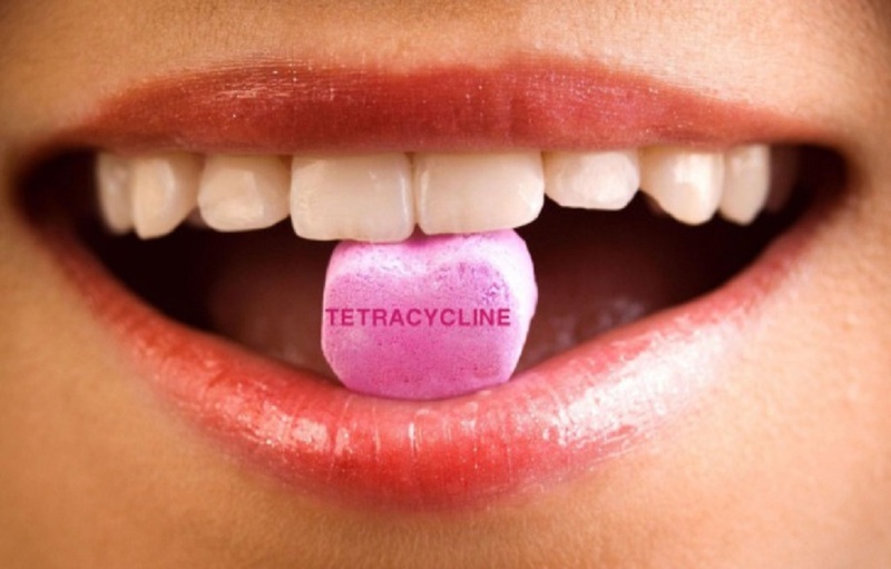 Răng nhiễm Tetracycline là gì? Cách khắc phục hiệu quả - Nhà thuốc FPT Long  Châu