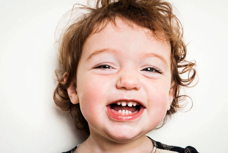 Răng sữa mọc lệch là như thế nào? Nguyên nhân khiến răng sữa mọc lệch 2