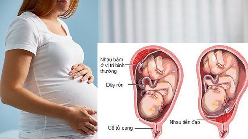 Rau tiền đạo là gì? Liệu có nguy hiểm không? 2