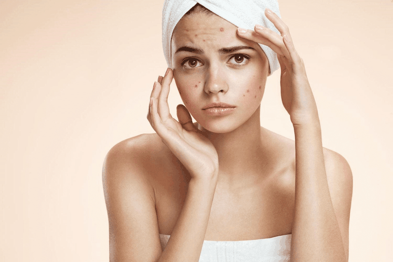Review kem chống nắng Avene cho da dầu mụn Cleanance Sunscreen 1