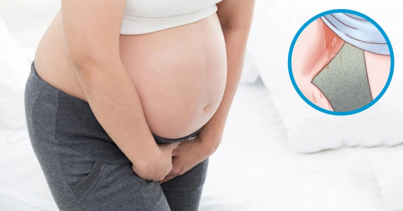 Rỉ ối bao lâu thì sinh? Dấu hiệu vỡ ối mà mẹ bầu cần biết 1