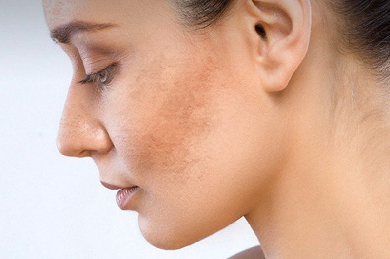 Rối loạn nội tiết tố nữ sau sinh, các chị em cần biết 2