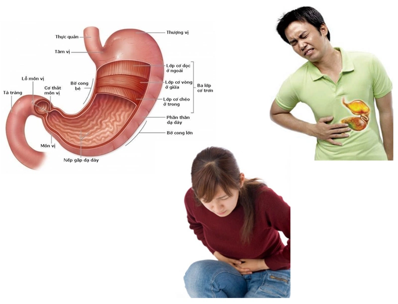 Rượu bia làm nhiều người khốn khổ vì viêm loét dạ dày 1