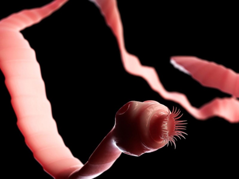 Nhiễm sán gây ra nhiều triệu chứng bệnh khác nhau