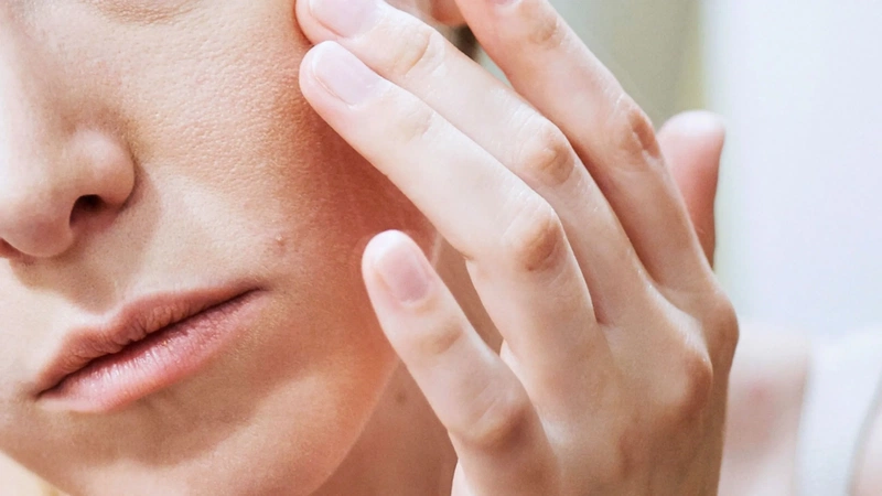 Sản phẩm dưỡng da nào phù hợp cho da bệnh chàm? 1