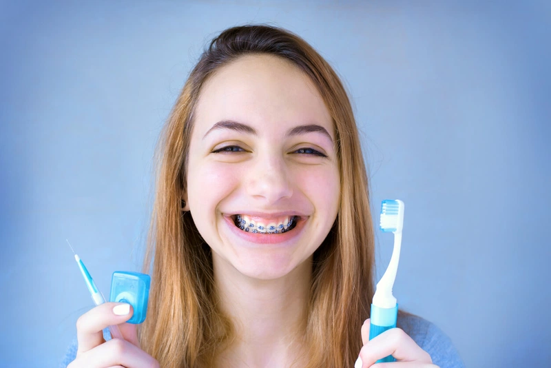 Sâu răng khi niềng răng: Cần lưu ý những điều gì? 4