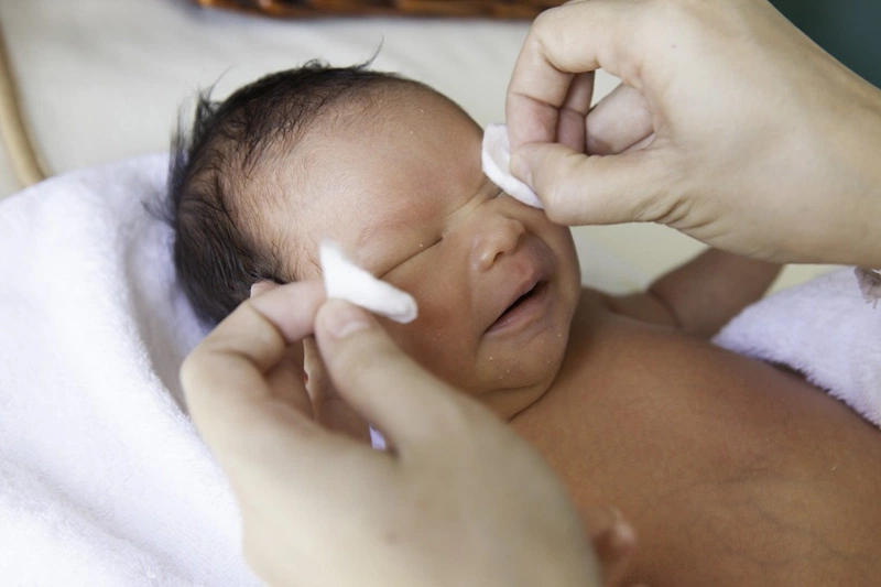 Mẹ bỉm sữa nên làm gì khi sau sinh bị đau mắt đỏ 3