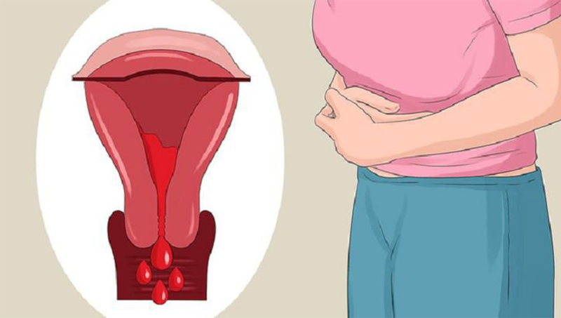 Sảy thai và thai lưu có giống nhau không? 2