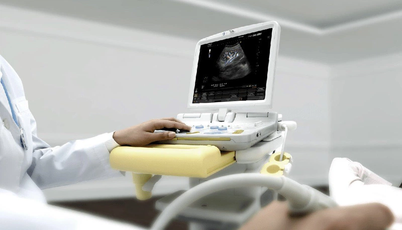 Siêu âm thận để làm gì? Lợi ích khi siêu âm thận 3