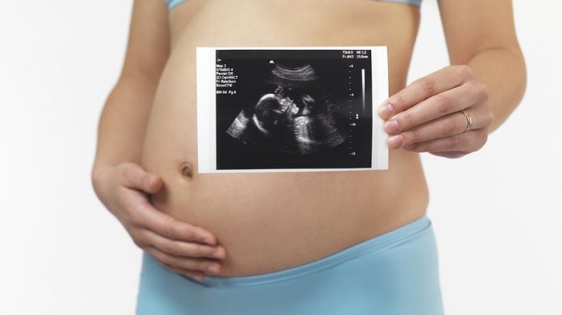 Siêu âm tim thai là phương pháp chẩn đoán trước sinh để phát hiện, chẩn đoán và điều trị sớm bệnh tim bẩm sinh