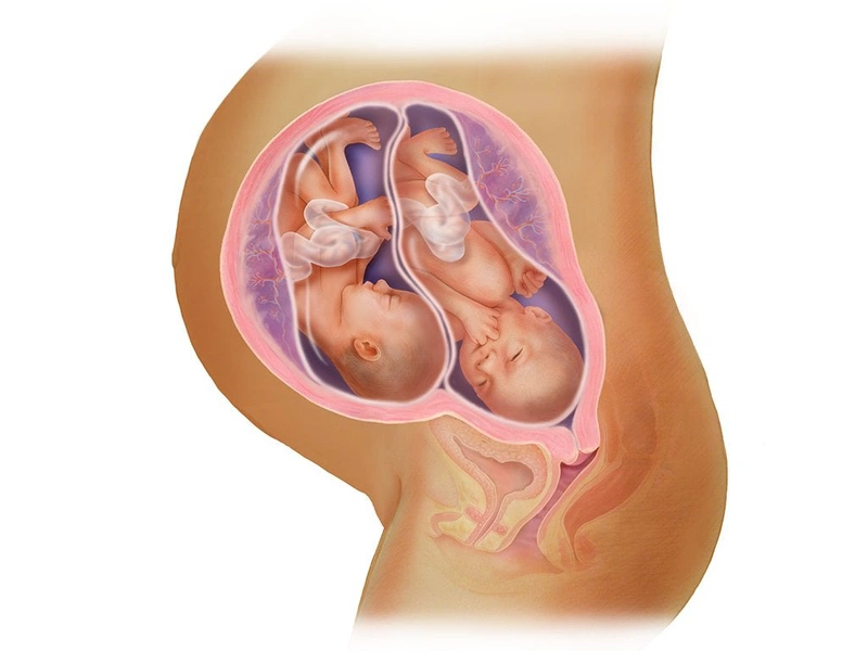 Sinh đôi cùng trứng và sinh đôi khác trứng có giống nhau không? 