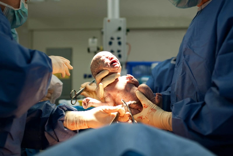 Sinh mổ lần 2 liệu có nguy hiểm không? Những lưu ý sản phụ nên biết 2