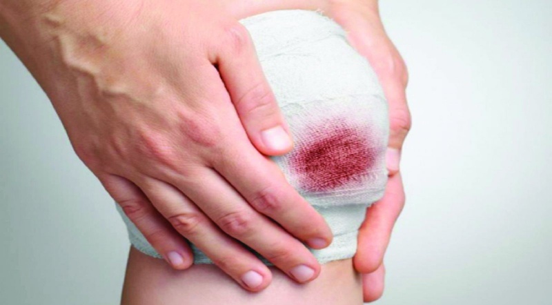 Sơ cứu cầm máu vết thương: Một số điều cần lưu ý 2