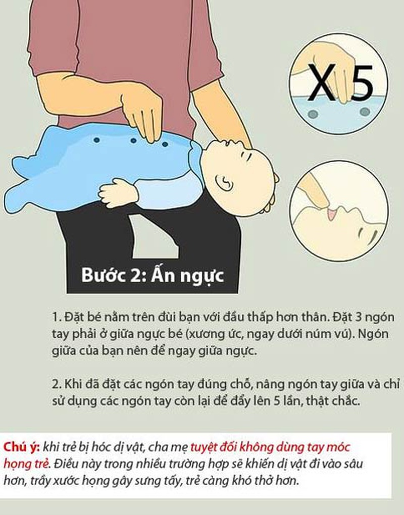 Sơ cứu trẻ bị sặc cháo, sữa tại nhà - Kiến thức phải biết