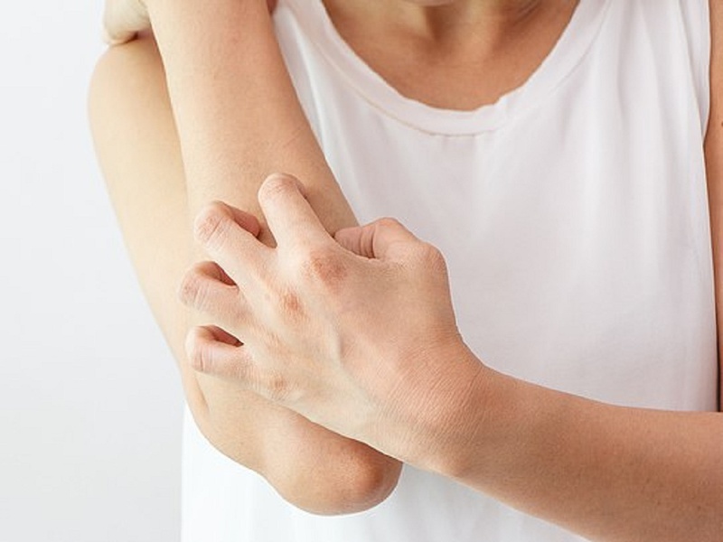 Sốt phát ban là gì? Sốt phát ban ở người lớn kiêng gì để nhanh bình phục? 4