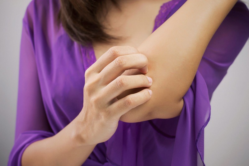 Sốt viêm não nhật bản - dấu hiệu nhận biết sớm 3