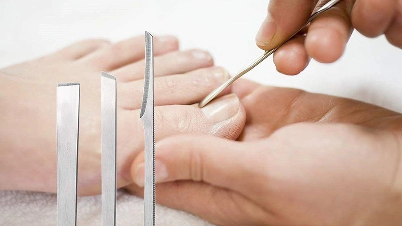 Sử dụng cây lấy khóe móng chân đúng cách 2