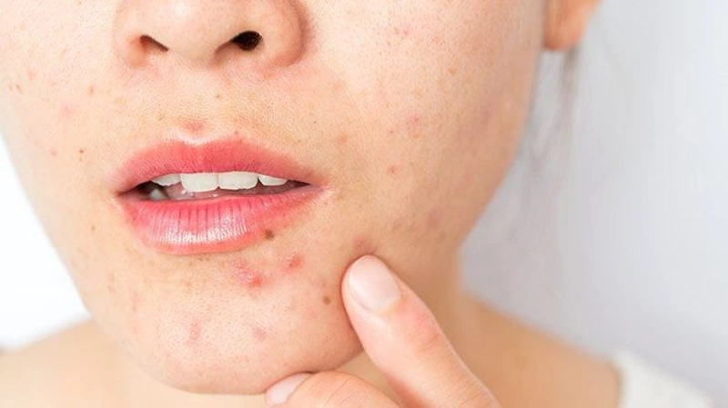 Sử dụng treatment bao lâu thì mới phát huy tác dụng 3