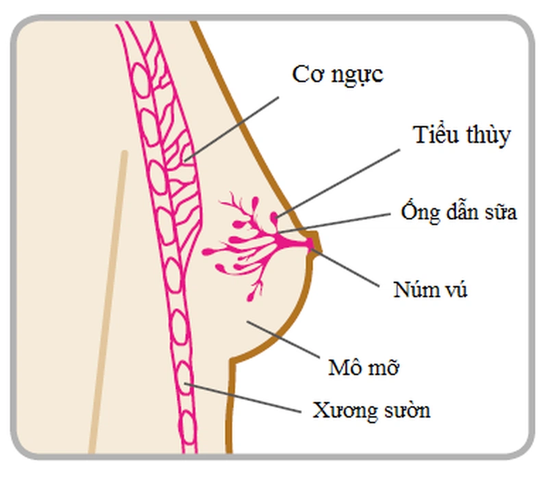 Sự hình thành khối u tiểu thùy và nguy cơ phát triển ung thư vú 1