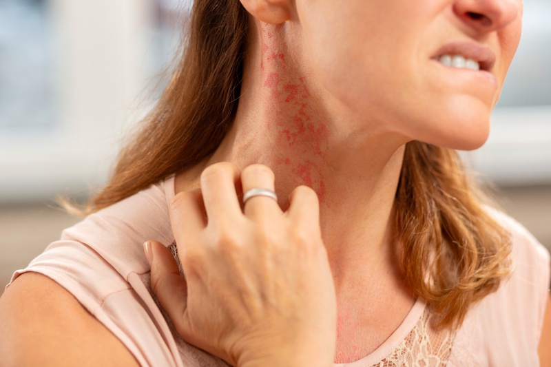 Sự khác biệt giữa: Dị ứng thực phẩm và không dung nạp thực phẩm là gì? 1