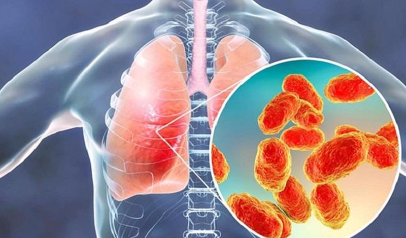Sau điều trị ung thư bệnh nhân có thể viêm phổi