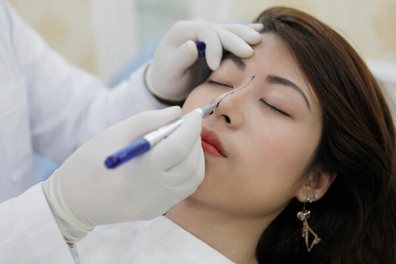 Tác hại của nâng mũi bằng sụn tai bạn biết chưa?