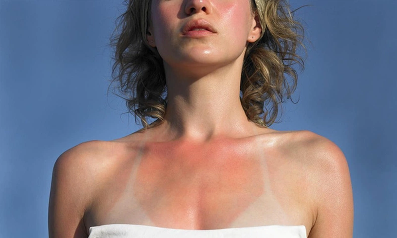 Tác hại của tia UV Cách bảo vệ làn da trước ảnh hưởng của tia UV 2