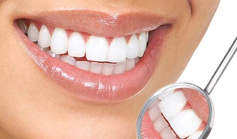 Tái khoáng răng là gì? Đây là phương pháp bổ sung khoáng chất cho răng