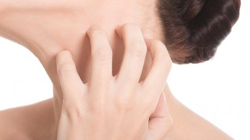 Tại sao lại bị bệnh vảy nến?