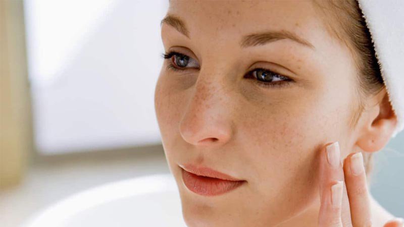 Tàn nhang là gì? Các nguyên nhân dẫn đến tàn nhang trên da mặt 1