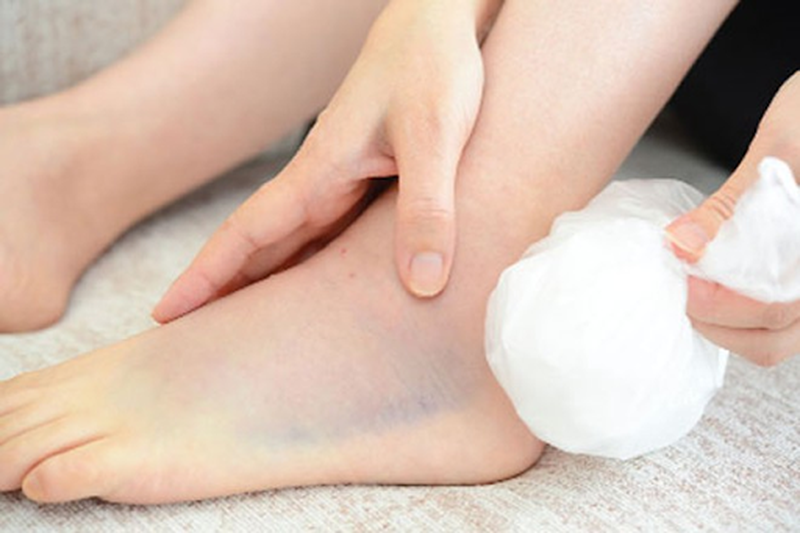 Các bài tập vật lý trị liệu bong gân cổ chân mà bạn nên biết 2