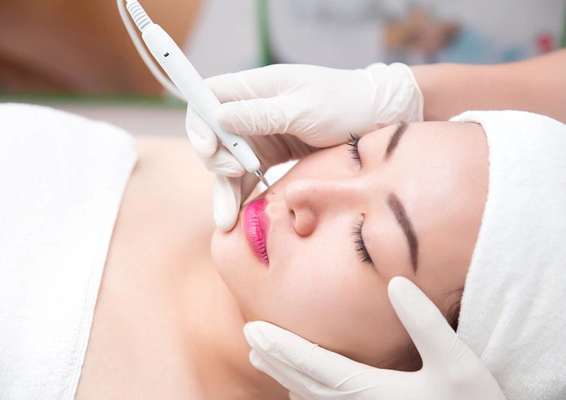 Nốt ruồi son là gì? Làm thế nào để xóa nút ruồi son? 4