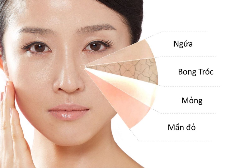 Tẩy tế bào chết cho da nhạy cảm và những điều cần biết 2