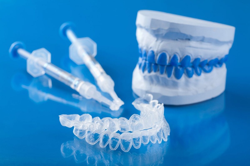 Sử dụng máng tẩy để tẩy trắng răng tại nhà