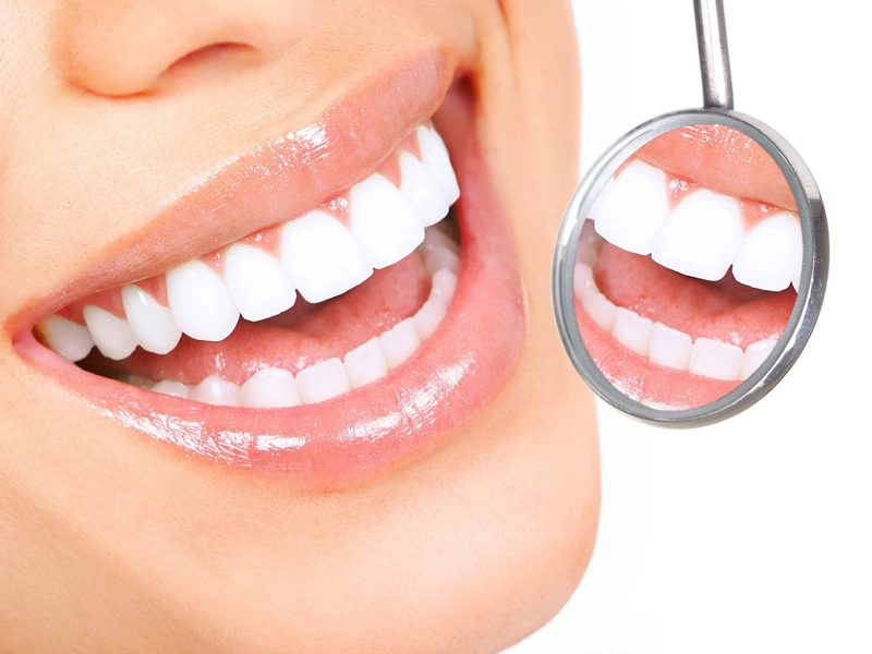 Tẩy trắng răng giúp răng trắng hơn so với ban đầu