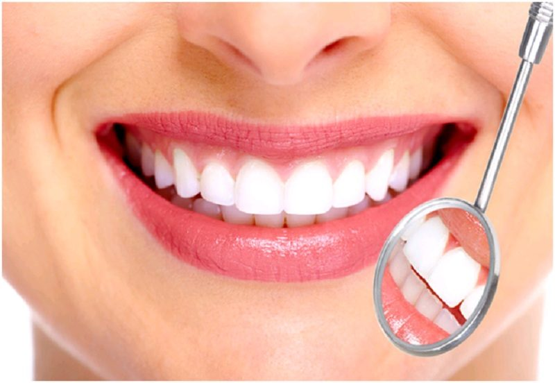 Có thể xử lý tình trạng tẩy trắng răng không đều màu bằng phương pháp bọc răng sứ