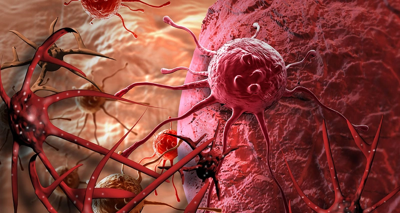 Thông tin từ A đến Z về tế bào ung thư trong cơ thể người 1