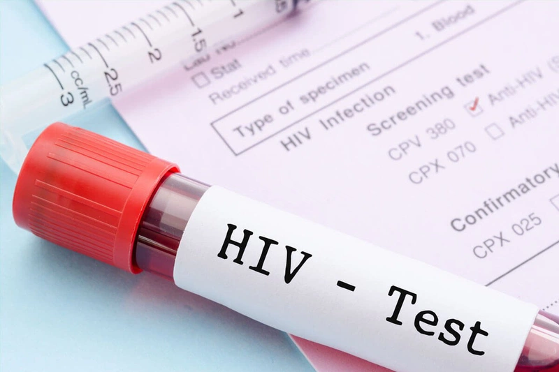 Mục đích của việc xét nghiệm HIV