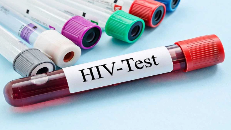 Chi phí xét nghiệm HIV