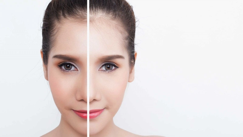 Thắc mắc: Ăn gì để da trắng sáng, mịn màng tự nhiên? 1