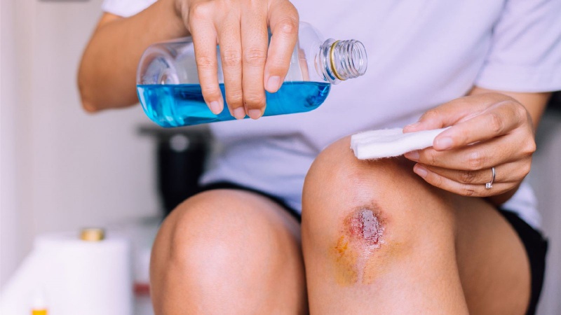 Thắc mắc: Ăn gì để không bị sẹo?  2