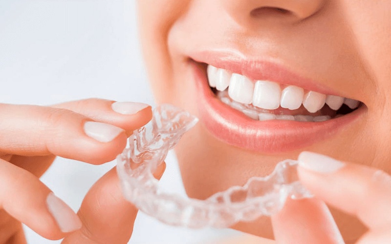 Thắc mắc: Niềng răng trong suốt có đau không? 2