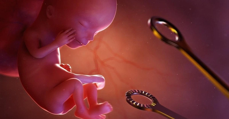 Thai ngoài tử cung có sinh được không và cách điều trị 3